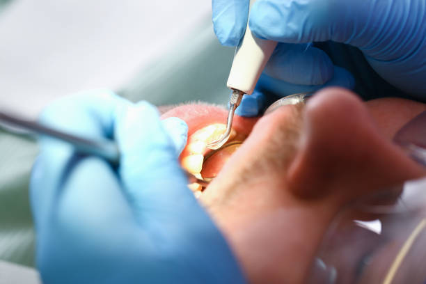 Best Emergency Denture Repair in Delta, OH