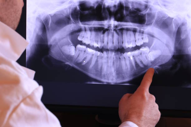 Best Emergency Treatment for Dental Infections or Abscesses in Delta, OH