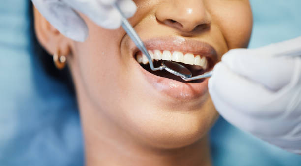 Best Emergency Dental Care for Broken or Chipped Teeth in Delta, OH