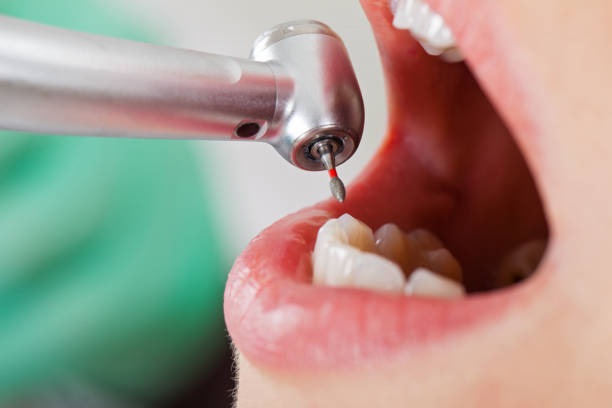 Best Emergency Gum Treatment in Delta, OH